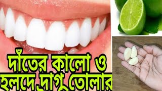 কালো হলুদ দাঁত কে বানায় মুক্তার মত চকচকে ব্যাবহার করুন মাত্র চারদিন কালো দাঁত পরিষ্কার করার উপায়//