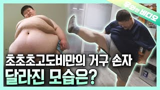 A Grandson with Superobesity, After a Year