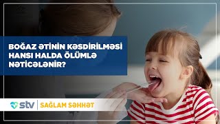 Boğaz ətini əməliyyat etdirmək nə üçün təhlükəlidir? - (12.02.2025)