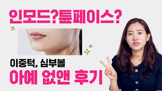 이중턱 없애려면 인모드 vs 튠페이스 중 어떤 게 효과 있을까?