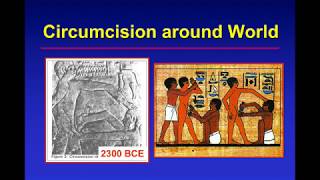 Circumcision: History, controversies & current guidelines