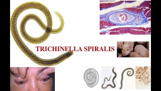 Triquinella spiralis
