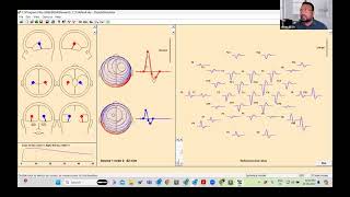BESA Research Workshop Tutorial 1D: Filtering