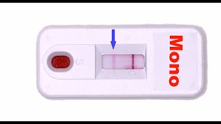 Rapid Mono Test: How Does it Work?