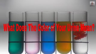 What Does The Color of Your Urine Mean?