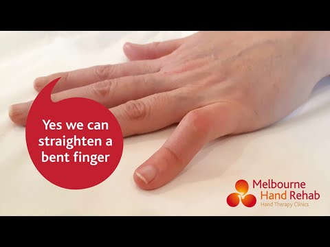 Why can’t I straighten my pinky finger?