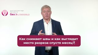 Как заживает рубец?