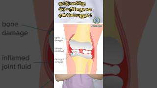 மூட்டு வலிக்கு CRP டெஸ்ட் ஏன் செய்யணும் | CRP test in Arthritis| Rheumatoid arthritis test|Arthritis