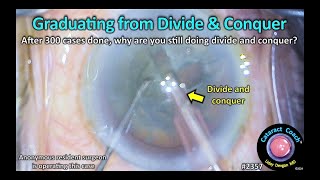 CataractCoach™ 2357: graduating from divide and conquer phaco cataract surgery