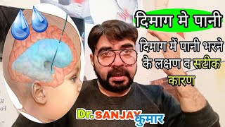 दिमाग में पानी भरने का इलाज | Encephalitis | Encephalopathies Treatment 100%