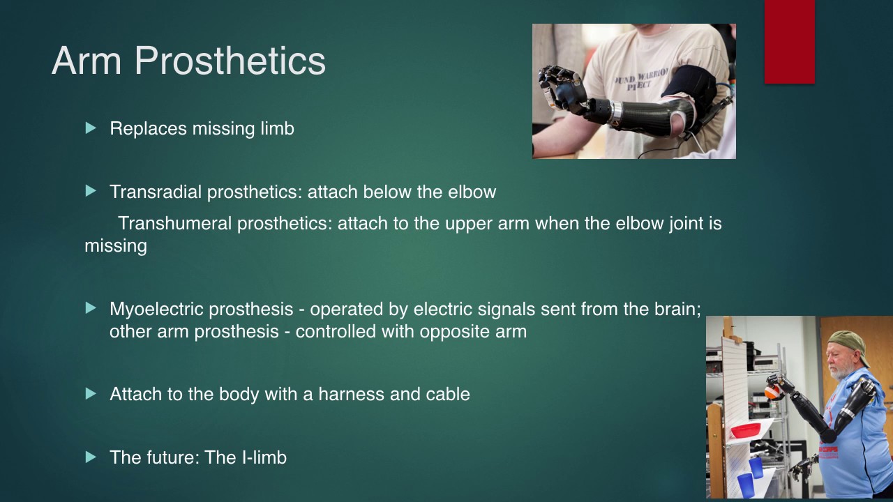 Types Of Prosthetics And Their Future - YouTube