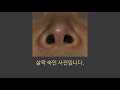 3세대 비공내리기 단독수술 전후사진 nostril show before and after nostril plasty plastic surger