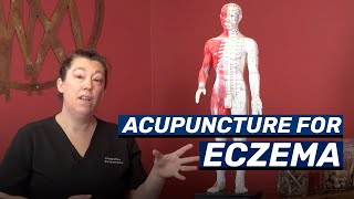 Acupuncture Treatment for Eczema