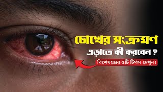 চোখের সংক্রমণ থেকে মুক্তি | I Cured My Eye Infection in 7 Days with THIS Trick! @Heltech4U