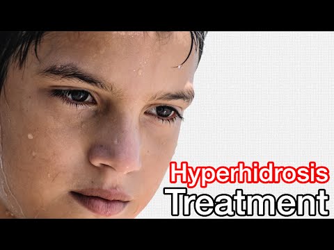 Hyperhidrosis Treatment // Learn How I Treated My Hyperhidrosis Naturally! Hyperhidrosis Treatment // Learn How I Treated My Hyperhidrosis Naturally!