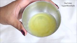 Get Rid of dandruff in 1 Day! _ Instant Dandruff Remedy at Home