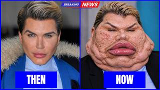 35 Stars Who Completely Ruined Their Faces With Plastic Surgery Disasters | Then and Now Photos 2026