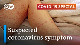 Coronavirus suspected of causing rare childhood disease | COVID-19 Special