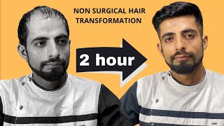 Natural Looking Hair Patch in India | Non surgical Hair Replacement | Hair Wig House