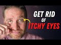 BEST 5 Tips For Red Itchy Eyes From Eye Allergies