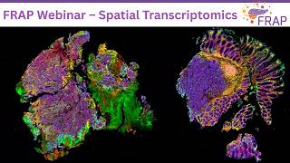 FRAP Webinar - Spatial Transcriptomics Technology