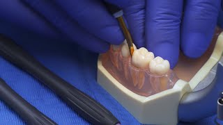 (EN) How to use? | Luxator & Luxator P-Series | Extraction Workflow with Dr. Manouchehr Kiaei.