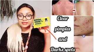 LEMON CLEAR SOAP REVIEW | how i cleared pimples