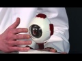 Dr Kluver - Subconjunctival Hemorrhage Dr Kluver - Subconjunctival Hemorrhage