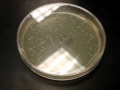 Bacterial Transformation Results