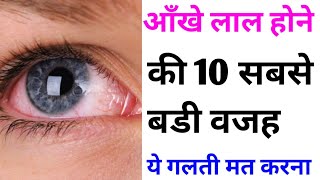 आँखे लाल क्यों होती हैं | Reasons of red eyes in hindi