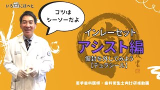 インレーセットのアシスト【仮封を外してみよう】デュラシール