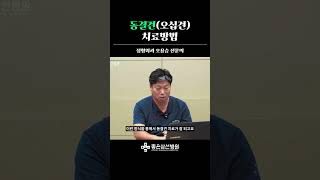 동결견(오십견) 치료방법