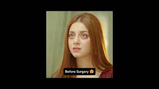 Alizay Shah before and after Surgery #alizayshah #alizehshah #celebrity #pakistaniactresse