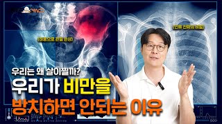 우리는 왜 비만이 되는 걸까? 비만을 방치하면 안되는 이유!