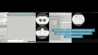 Effortless Workflow Clarity Smart DMPR