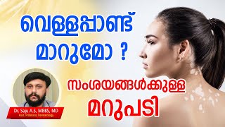 വെള്ളപ്പാണ്ട്  മാറുമോ? സംശയങ്ങൾക്കുള്ള മറുപടി Vitiligo Types, Symptoms, Causes, Treatment \u0026 Recovery