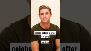 celebs before & after surgery | zac efron