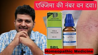 Number 1 Homeopathic Medicine for Eczema | Viola Tricolor | Homeopathic Medicine | How to Use