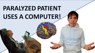 PARALYZED PATIENT COULD WORK ON PC VIA THE BRAIN IMPLANT STENTRODE