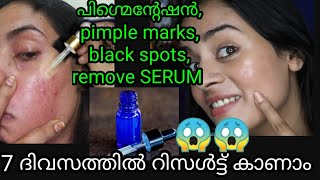 OMG This serum Amazing|Skin Corrector serum for pigmentation, dark spots, pimple marks, uneven skin