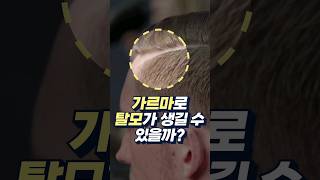 한 방향의 가르마로 탈모가 생길까?💡