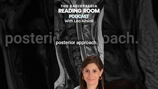 New episode on cervical canal stenosis!