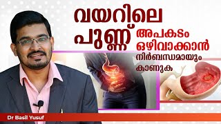 #Stomach#Ulcer#Homeopathy വയറിലെ പുണ്ണ് മാറ്റാൻ ഒരു സൂപ്പർ വിദ്യ | Dr.Basil's Health Tips