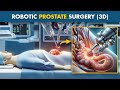 How Robotic Prostate Surgery Is Performed? | Robot Assisted Prostatectomy (3D Animation)