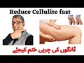 Reduce cellulite from thighs and hips, fast. Five best techniques. Look and feel good. In Urdu