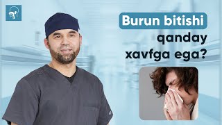 Oddiy burun bitishi qanday xavfga ega? | Dr Asqar Ashurov