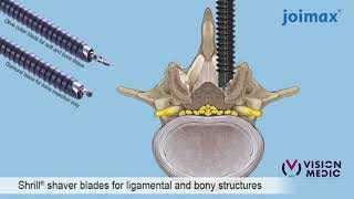 iLESSYS® Delta Live OR by Dr  Ralf Wagner Ligamenta, Frankfurt