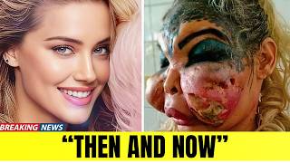 Famous Celebrities Unrecognizable After Plastic Surgery Gone Wrong | Then and Now 2026
