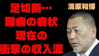 清原和博の“足切断”の真相や“難病”の現在の病状に言葉を失う…「野球」で活躍していた元選手のまさかの収入源や年収額に驚きを隠せない…