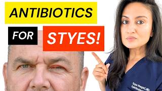 BEST Antibiotic For Stye Treatment | Get Rid Of Eye Stye | Chalazion Medication Ointment #stye